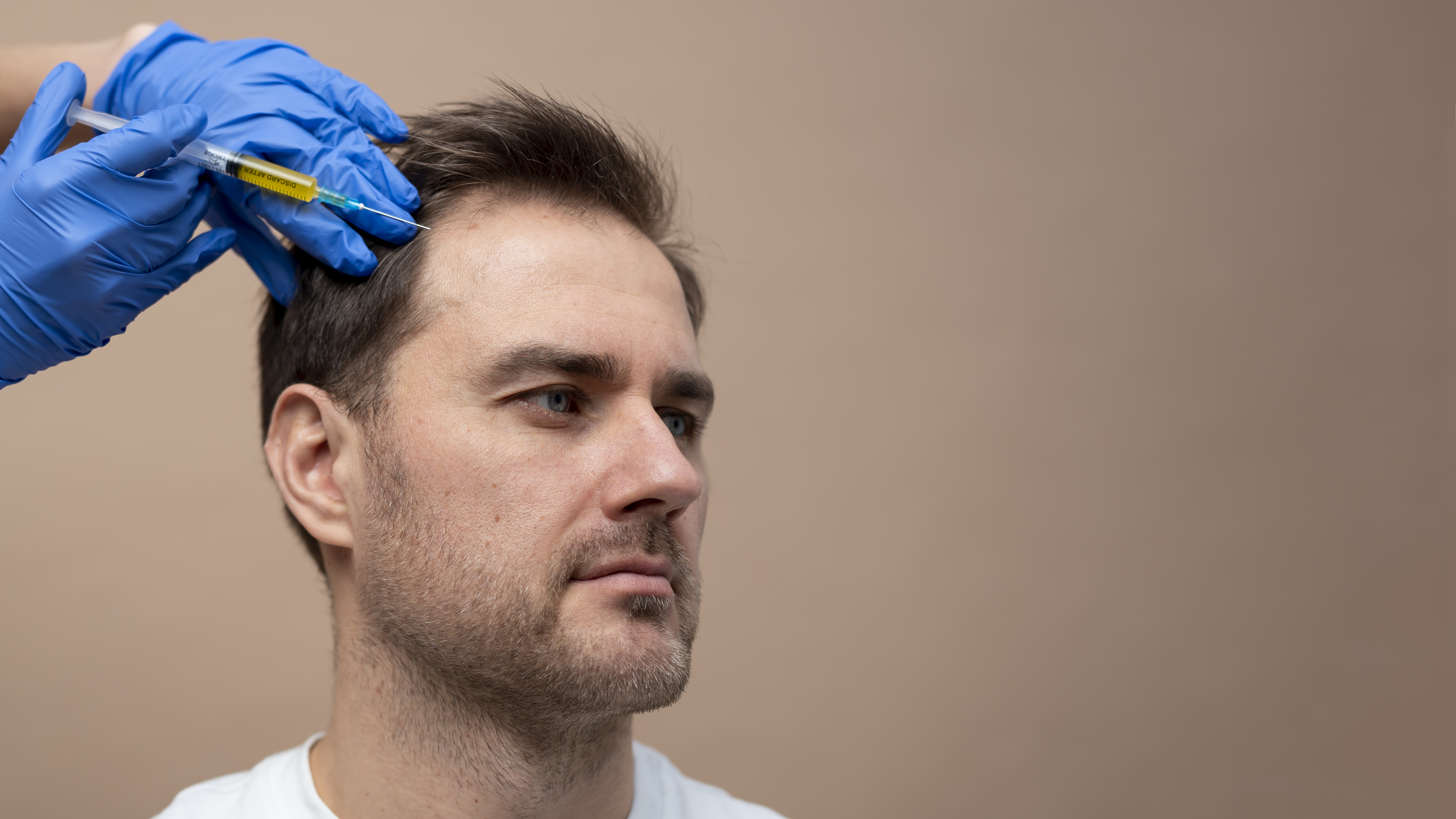 PRP Therapy