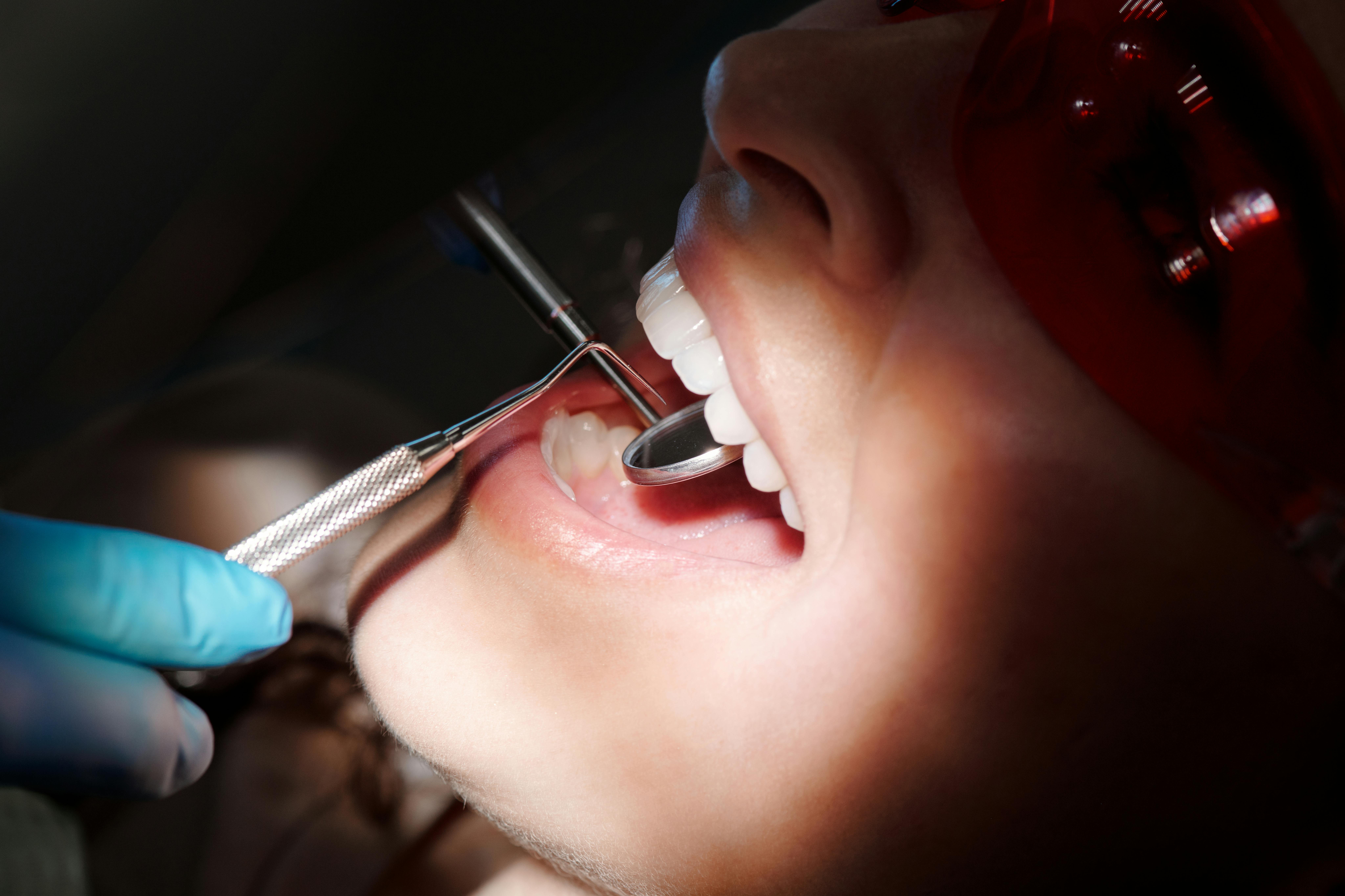 Teeth Whitening